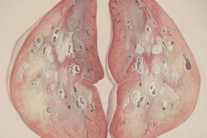 How to Keep Your Lungs Healthy Naturally: Best Daily Habits to Improve Breathing and Lung Strength