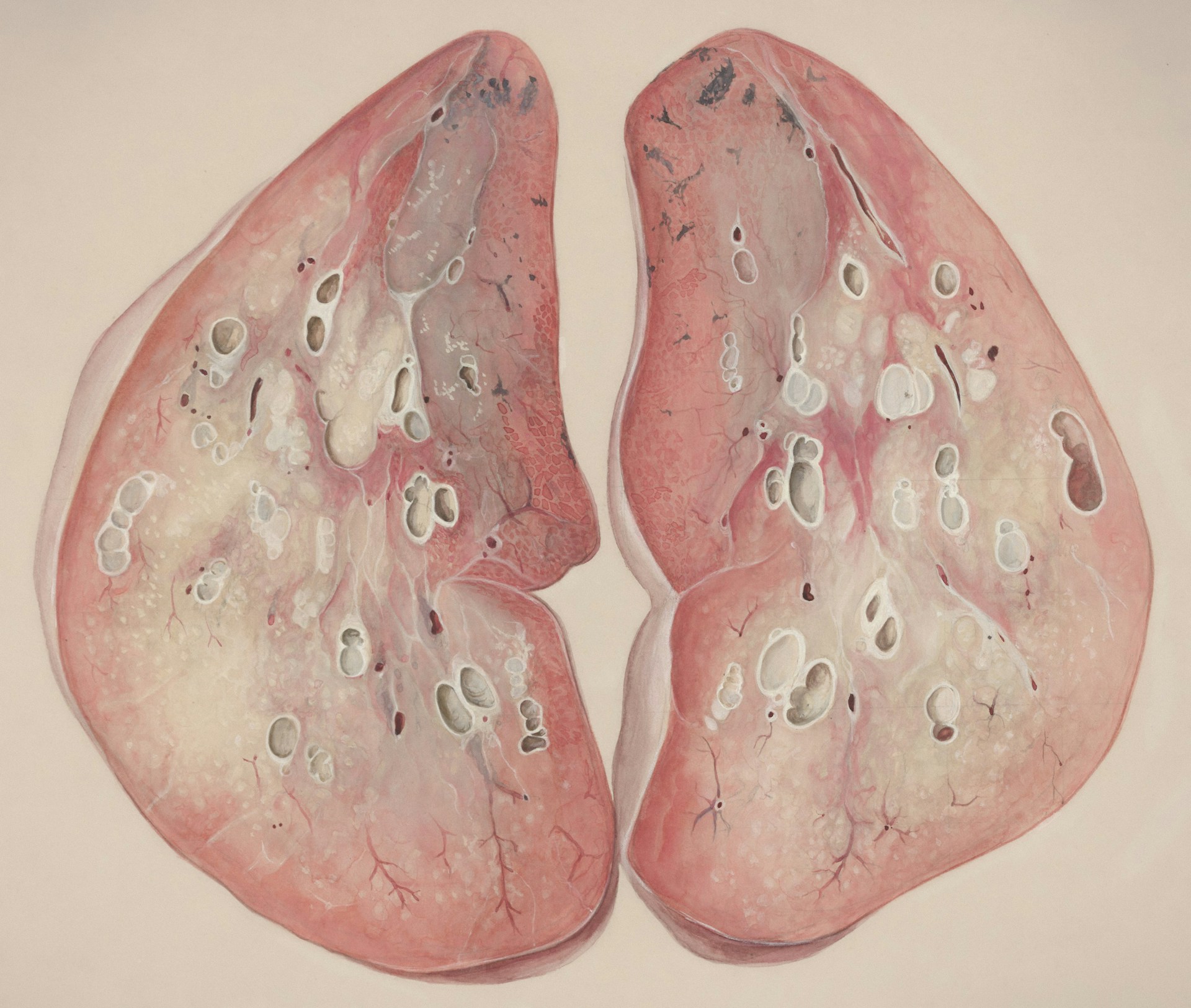 How to Keep Your Lungs Healthy Naturally: Best Daily Habits to Improve Breathing and Lung Strength