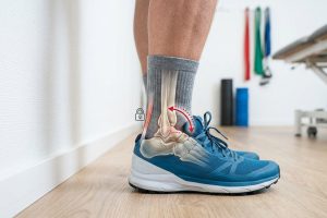 Improving Dorsiflexion: Why Stiff Ankles Ruin Daily Movement Mechanics and How to Mobilize Them